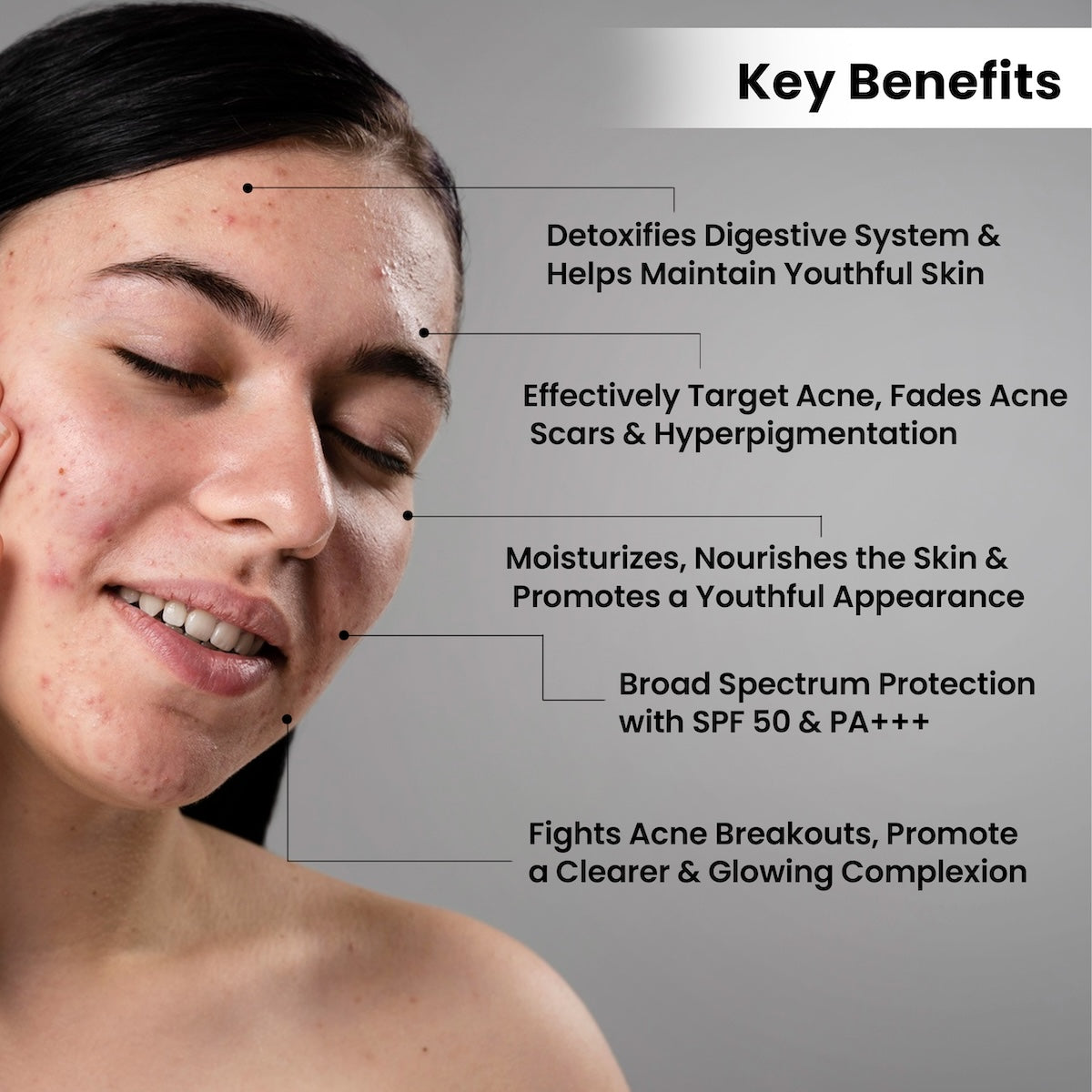 Anti Acne Medicated Treatment Kit (FREE Anti Acne Soap of MRP-190)