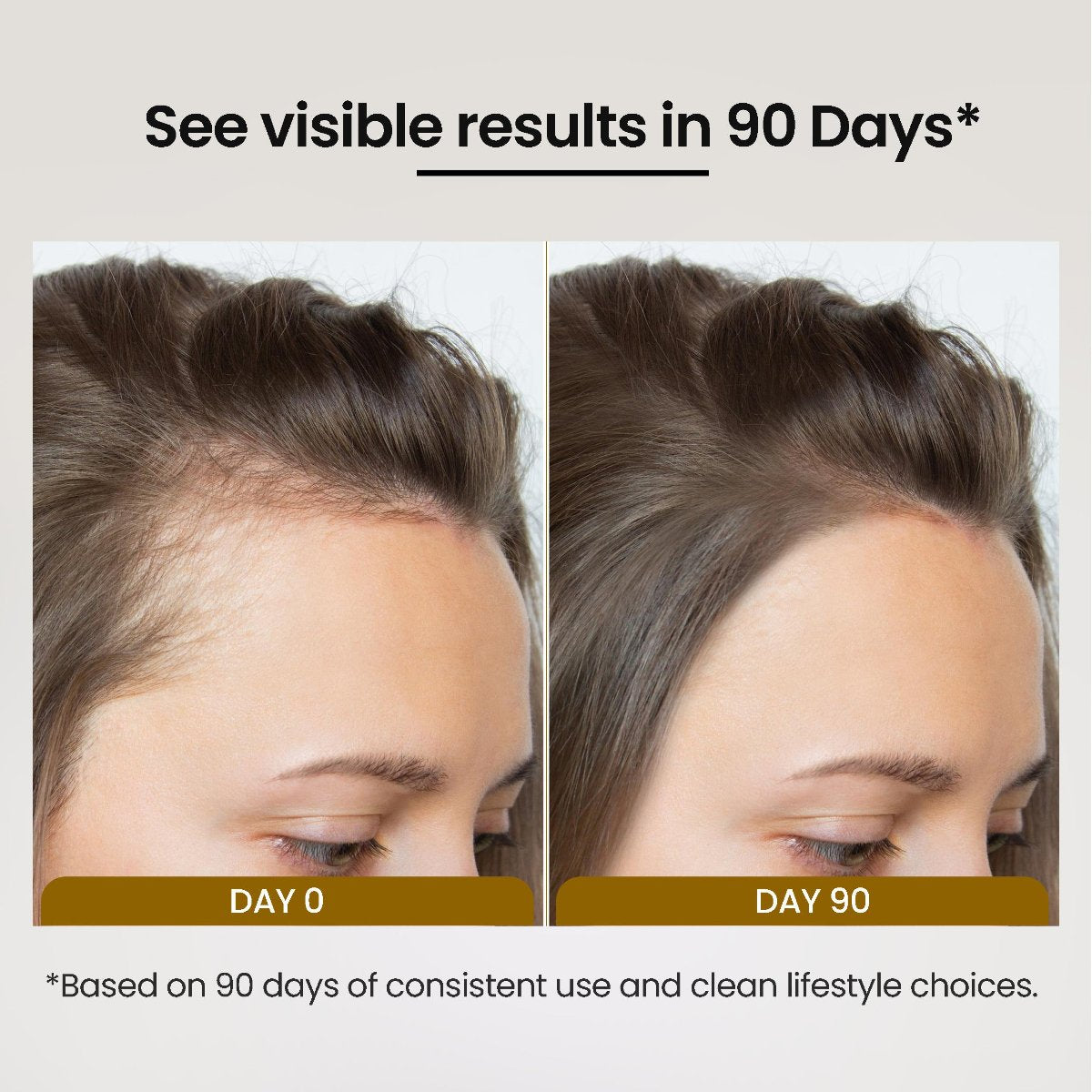 Biofolli-S Anti-Hair Fall Shampoo with Follicusan, Biotin, Argan & Onion Oil