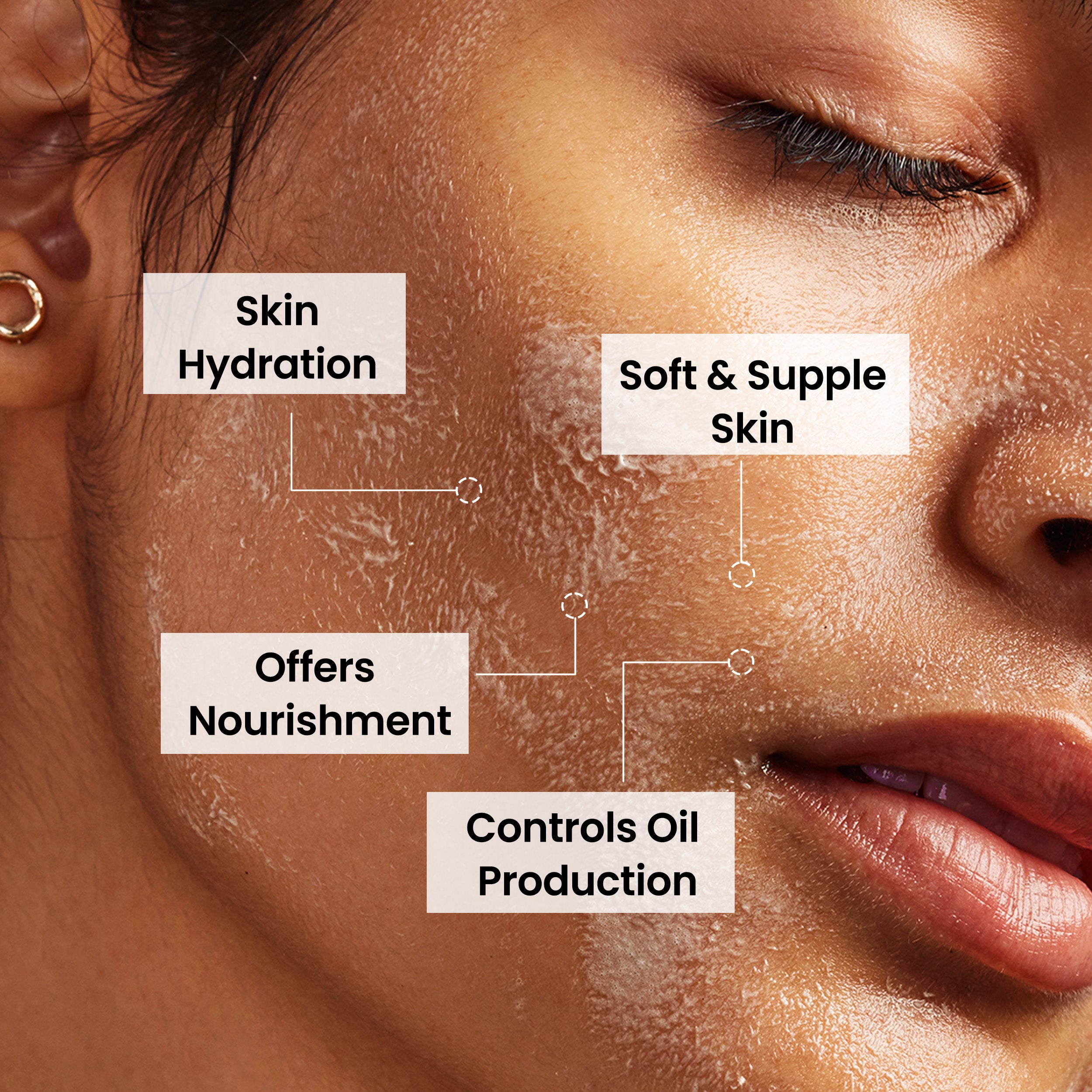 PHGLO Anti-Acne Soap: Fight Breakouts and Reveal Clearer Skin (Pack of 4)