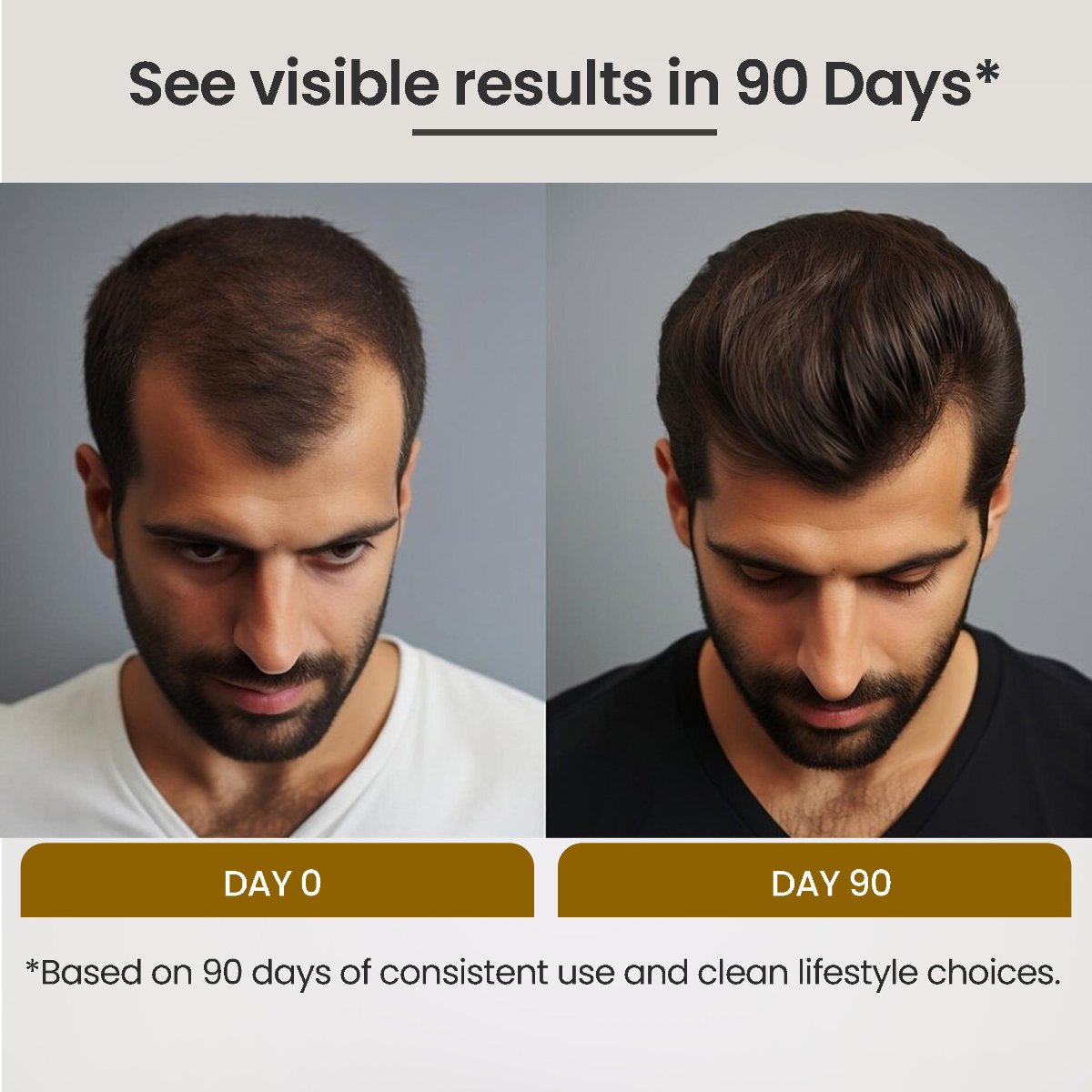 PHGLO Anti Dandruff Anti Hairfall Hair Growth Serum