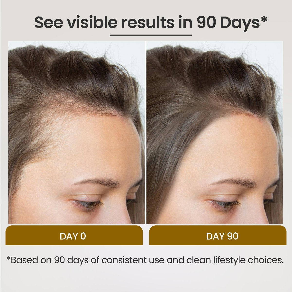 PHGLO Anti Dandruff Anti Hairfall Hair Growth Serum