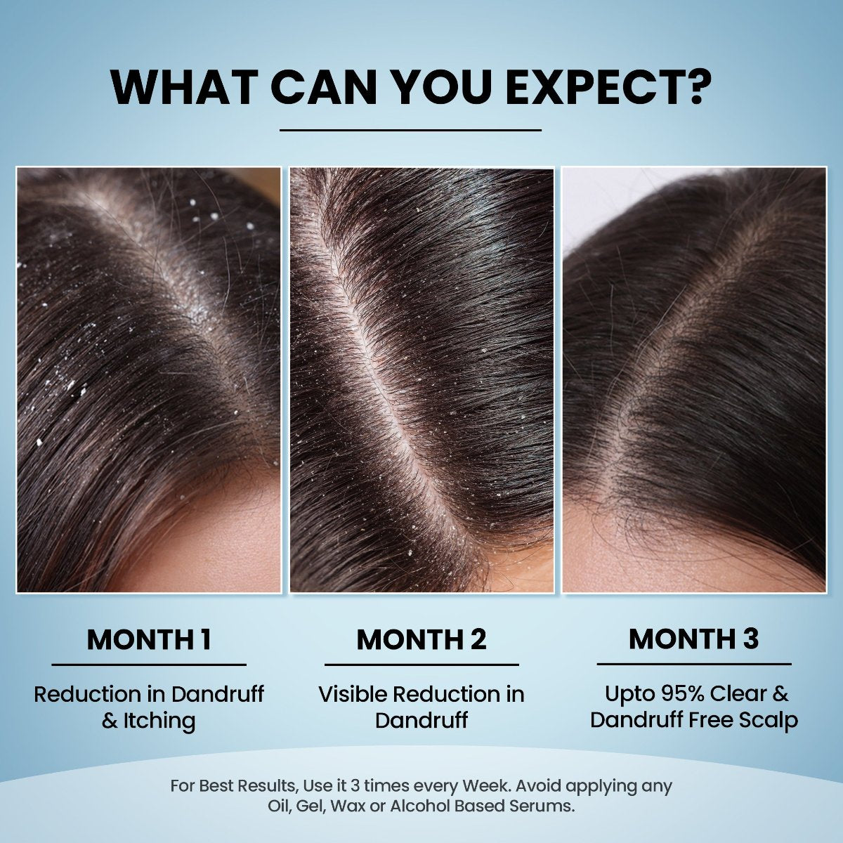 PHGLO Anti Dandruff Shampoo With Conditioner (FREE Doctors Consultation)